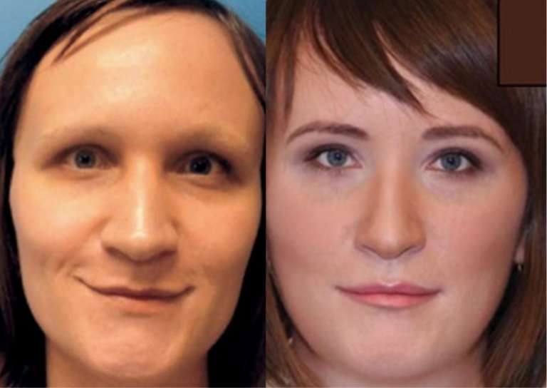 Gender1